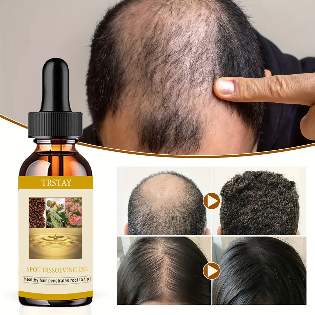 50ML aceite para el crecimient - Beard Oil reseña y precio